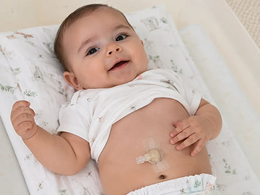 🌿 ¿Qué es una gastrostomía? Guía para familias